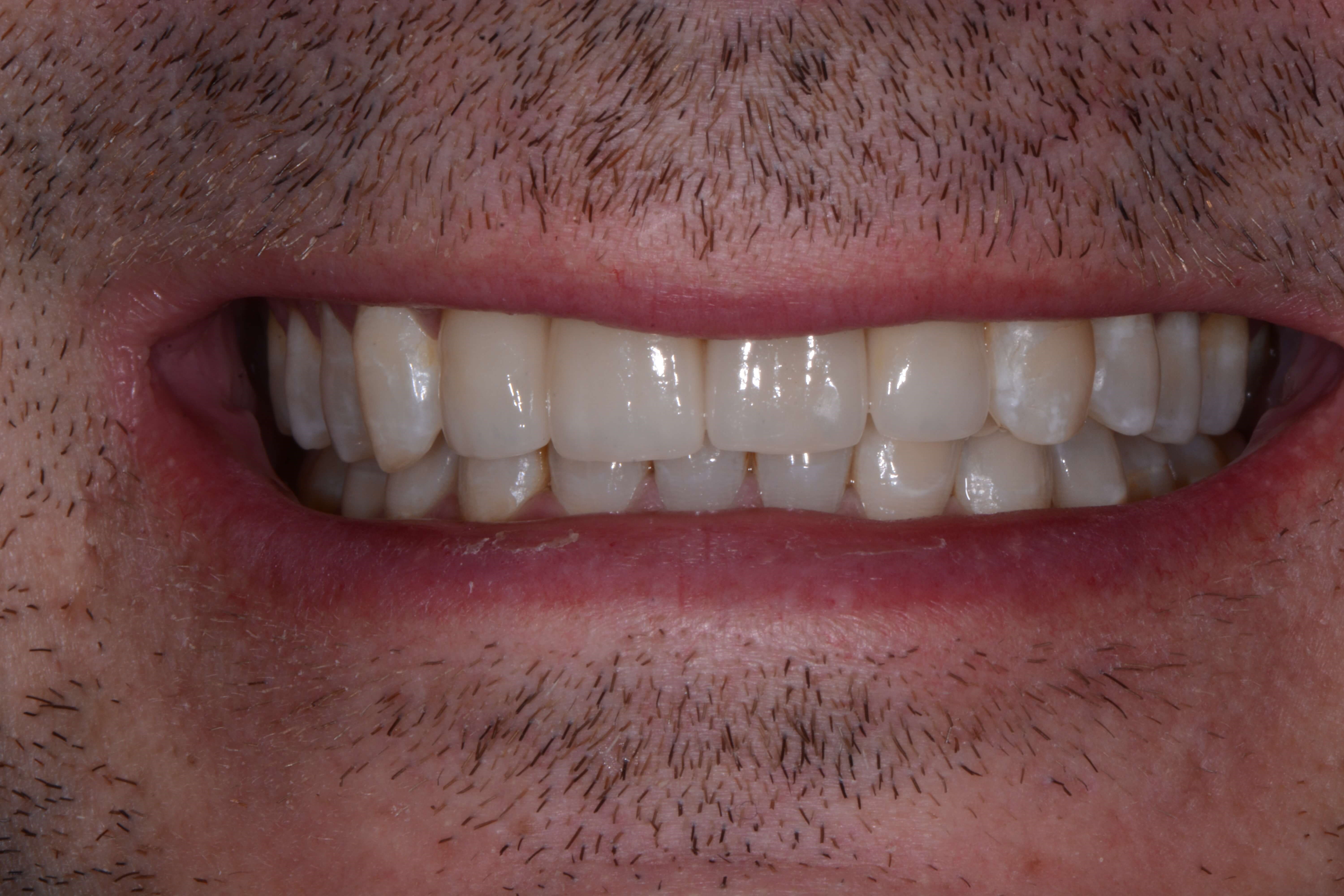 After Image