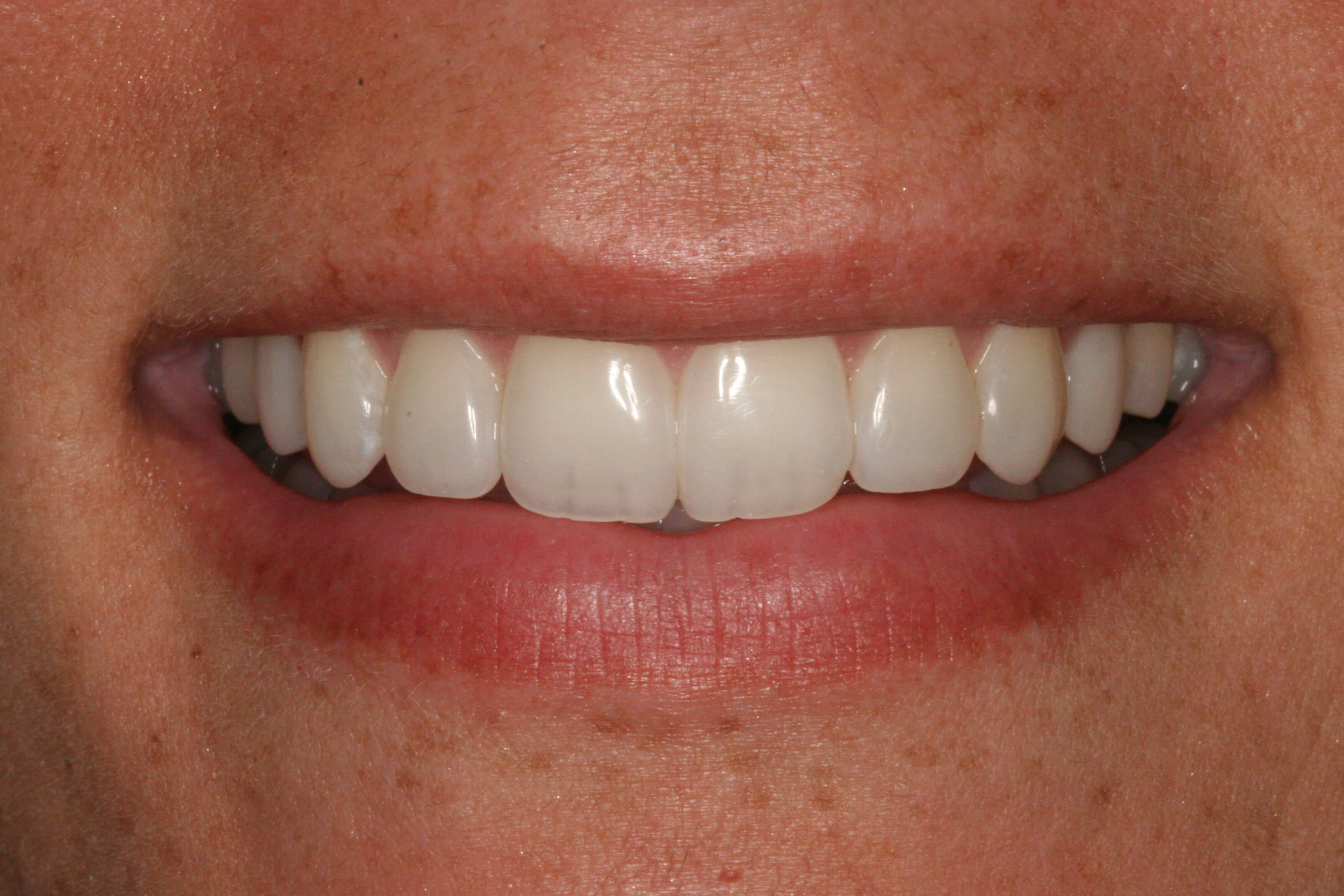 Uses Her Smile Daily! After